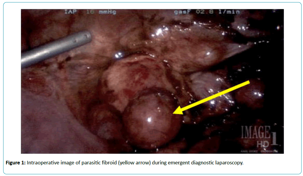 reproductive-endocrinology-Intraoperative-image