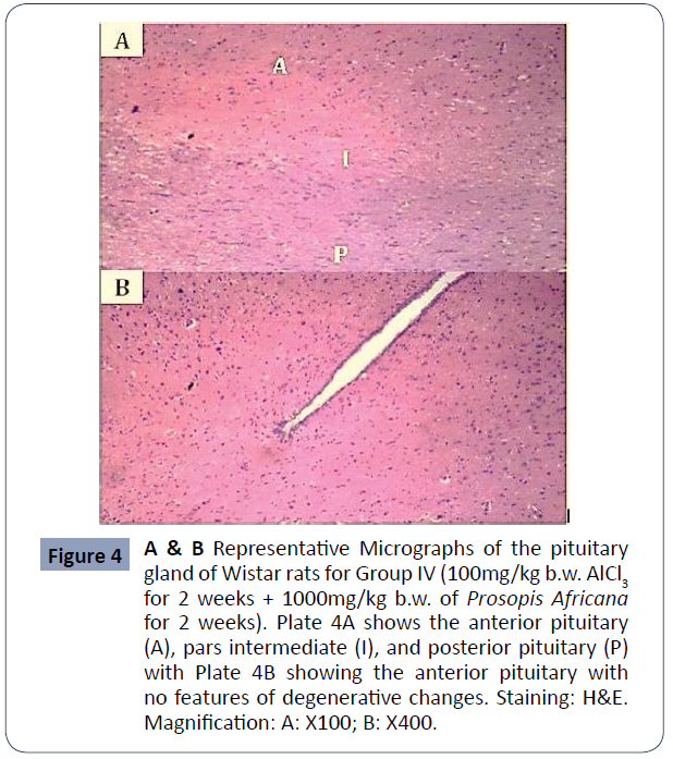 reproductive-endocrinology-infertility-Micrographs