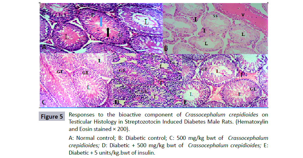 reproductive-endocrinology-infertility-diabetic-control