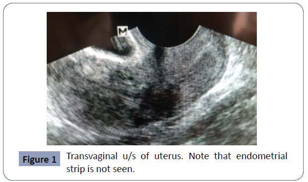 reproductive-endocrinology-infertility-endometrial