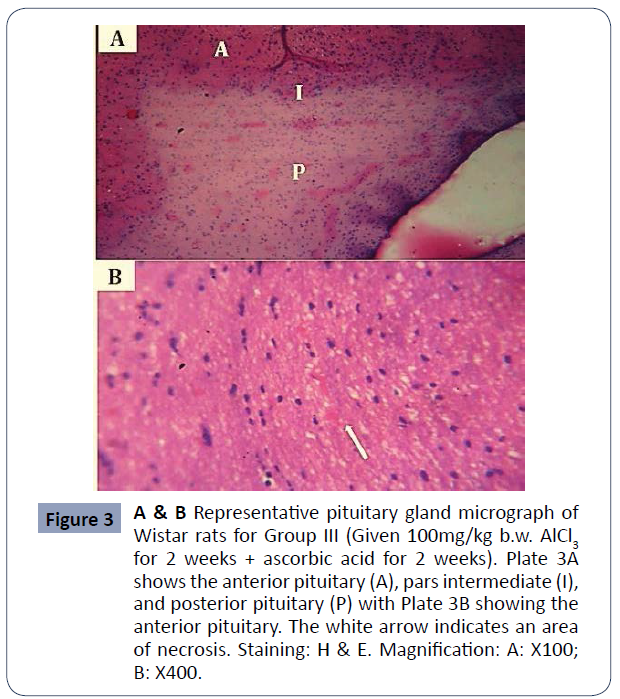 reproductive-endocrinology-infertility-gland