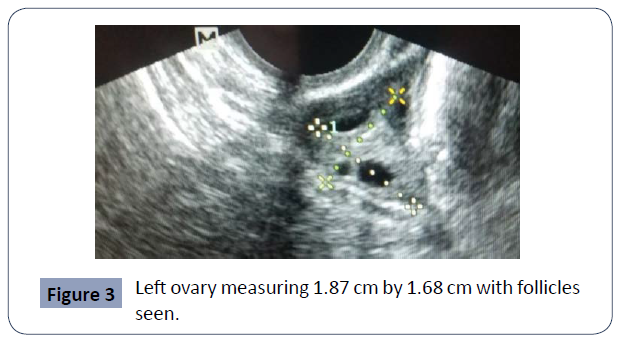 reproductive-endocrinology-infertility-measuring