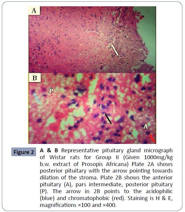 reproductive-endocrinology-infertility-pituitary